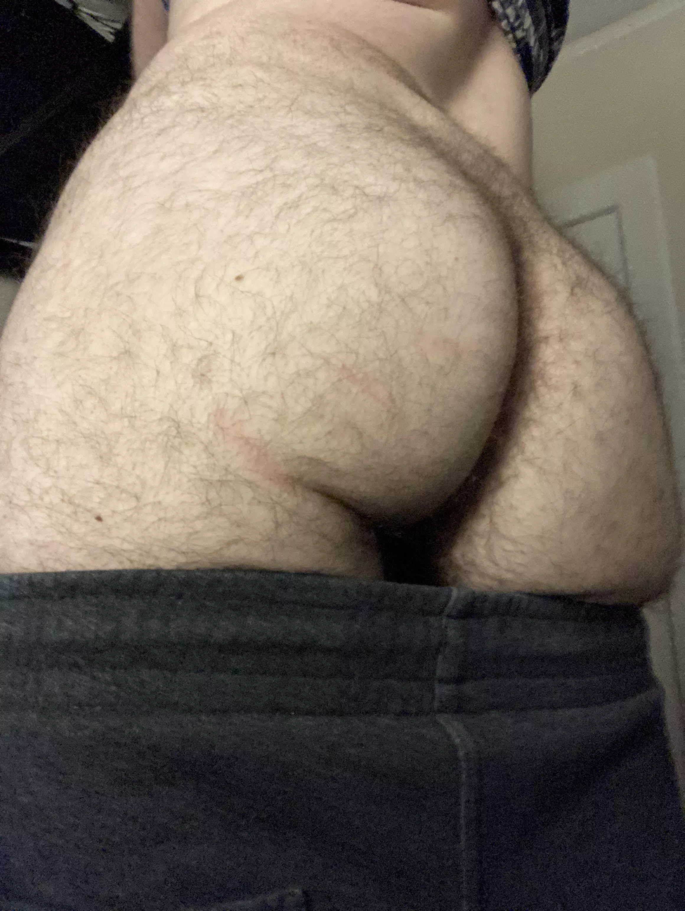 I love how hairy I am (21 FtM)