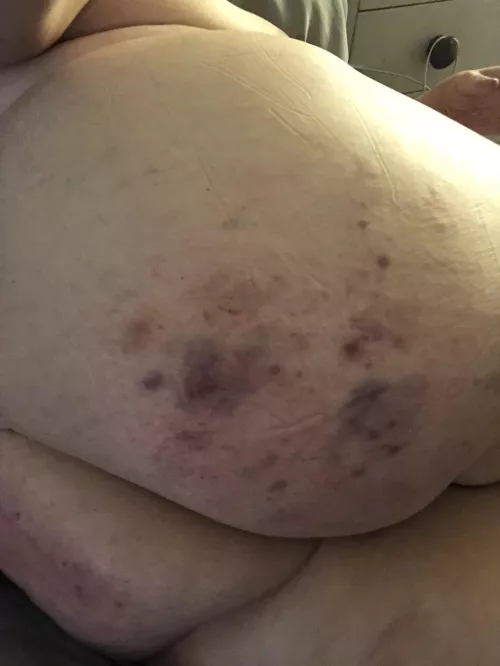 Punishment continues on the ass