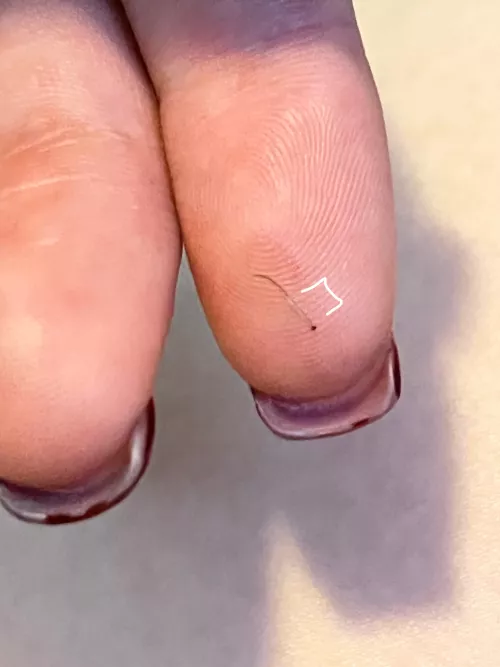 This hair I just plucked and the follicle on it