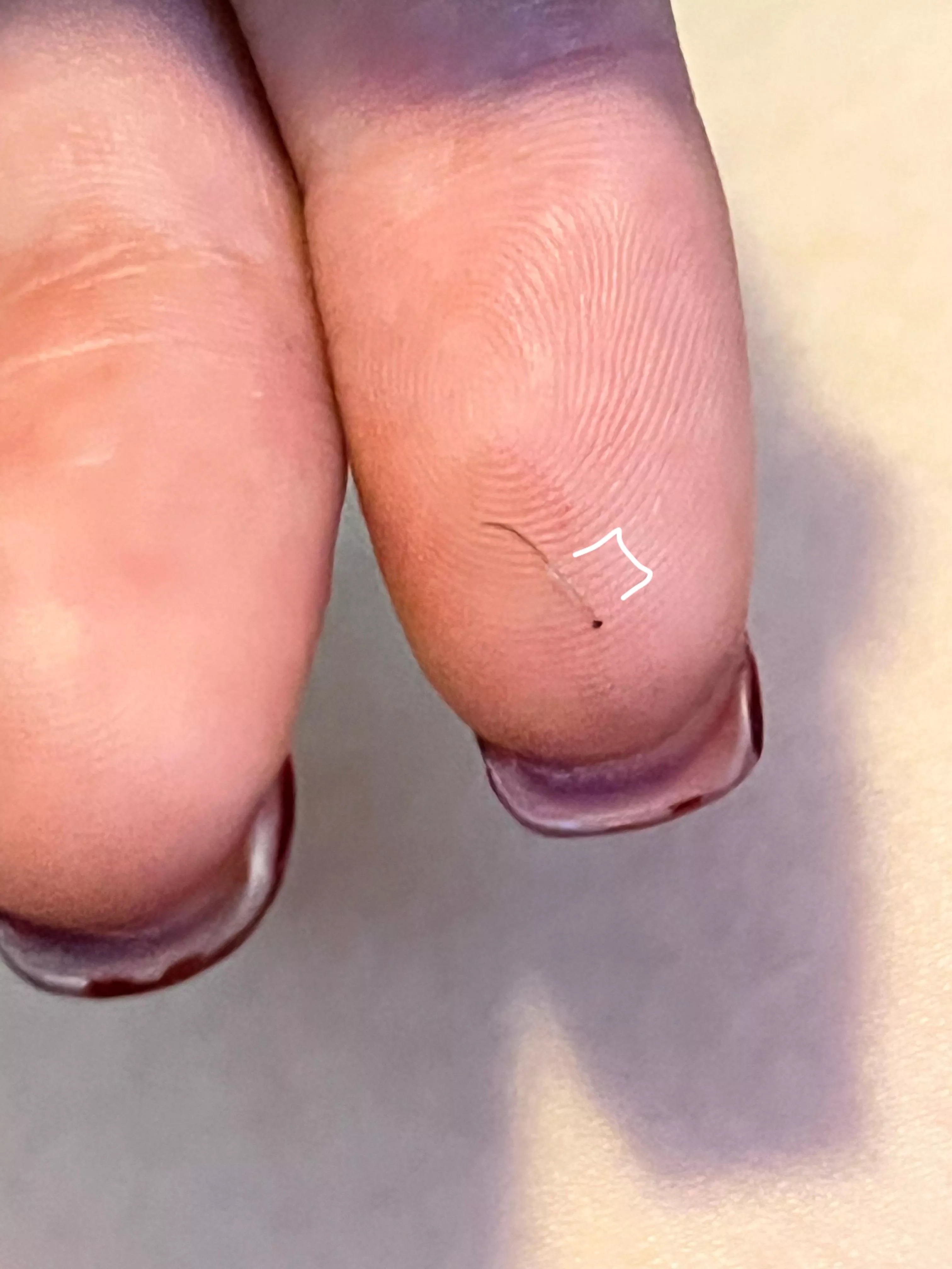 This hair I just plucked and the follicle on it