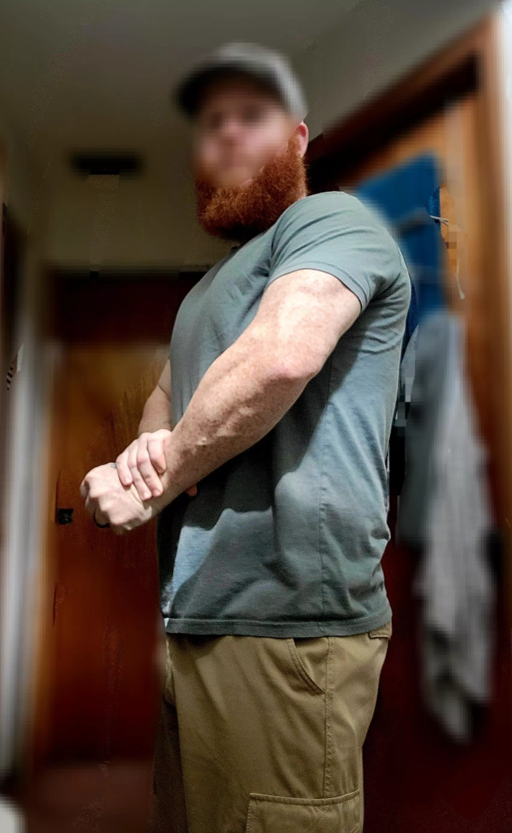 Ginger arms