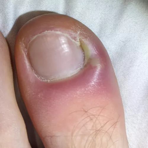 Taking every fibre of my body to not drain this damn thing rn.