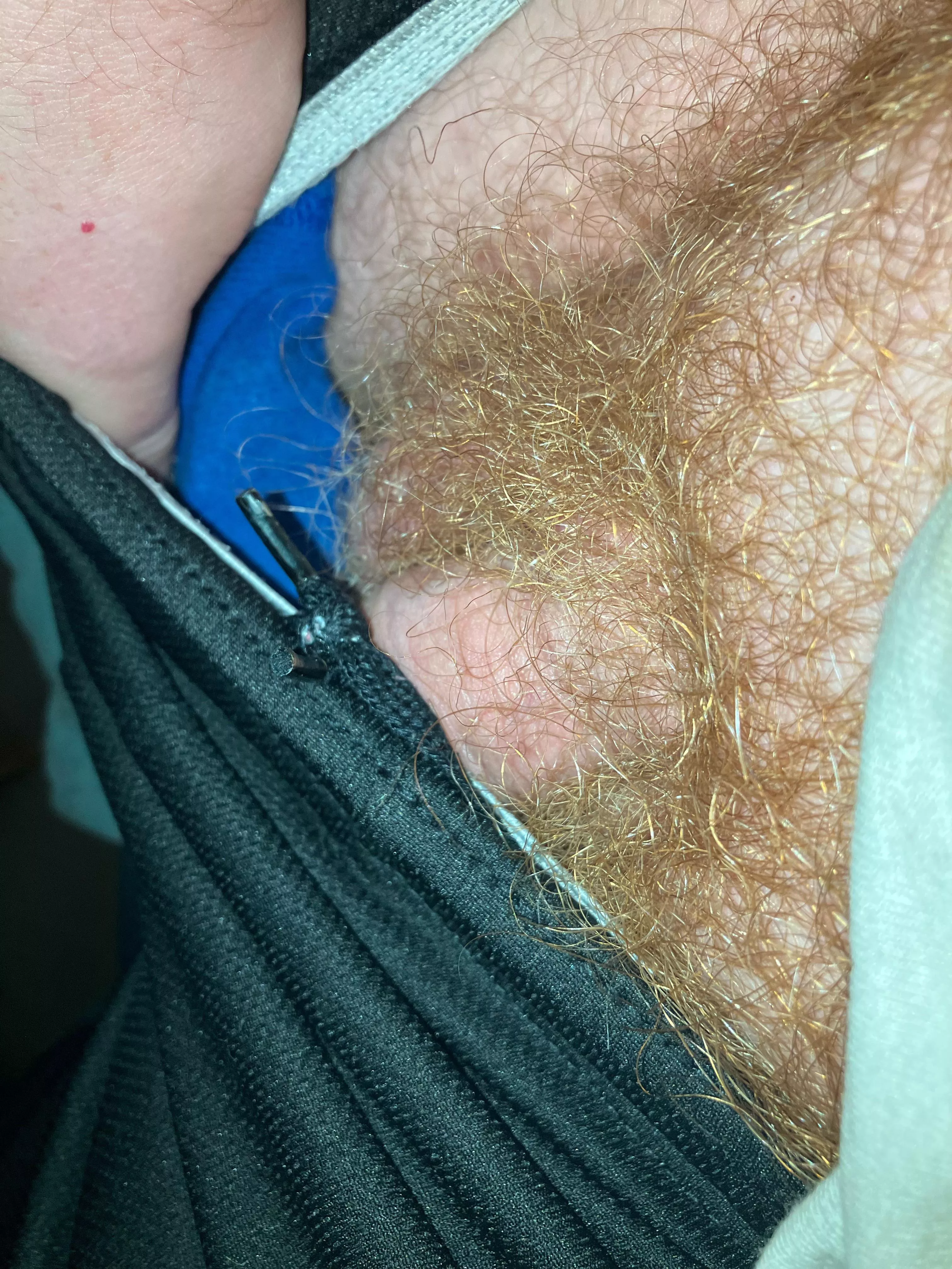 Anyone else have ginger pubes ?