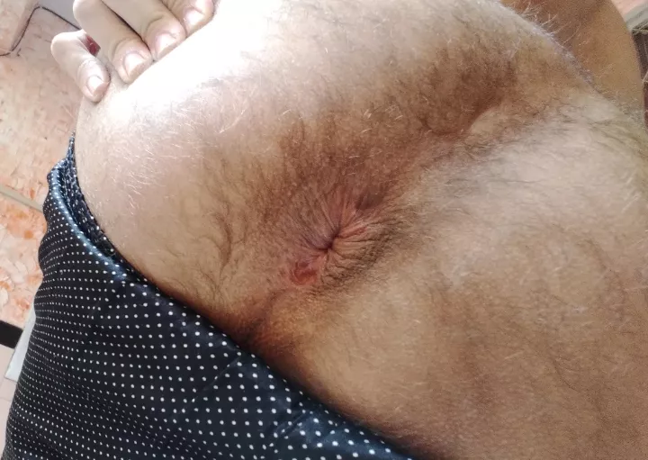 Outside soft asshole