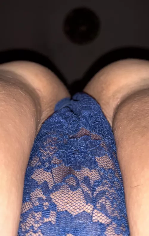 How do they look? Honest opinion please?