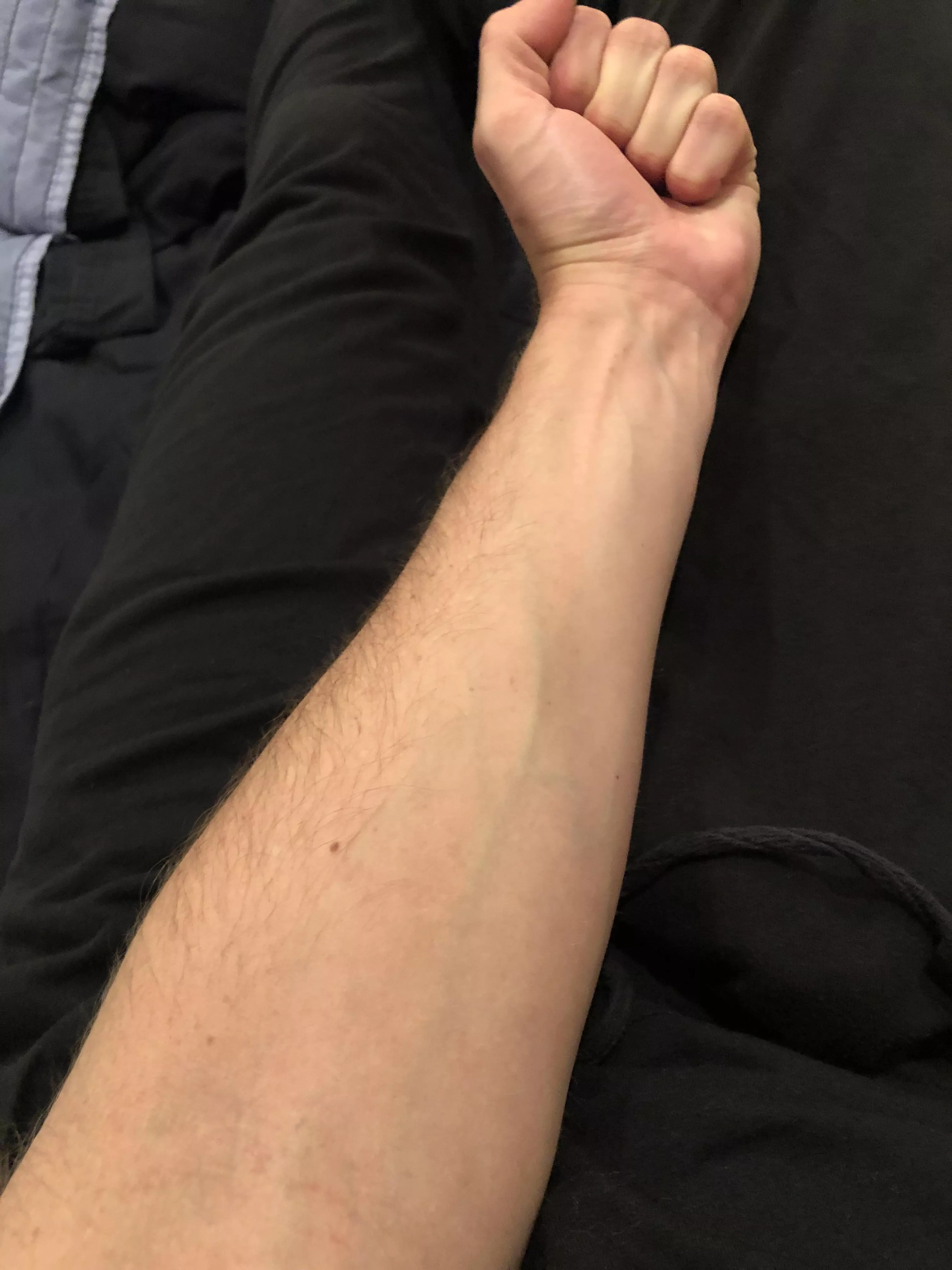 I feel weak on my forearm