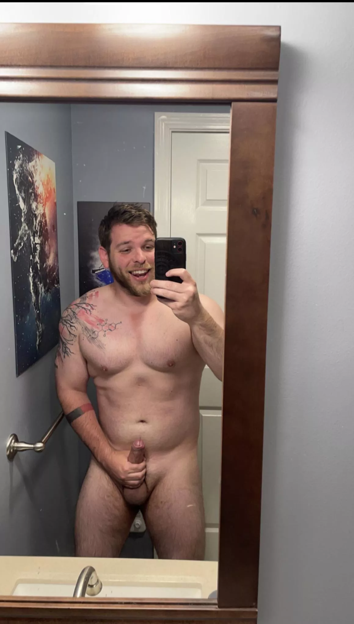 I have an odd sunburn