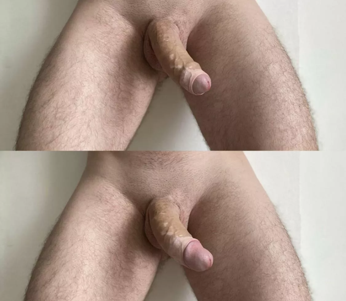 Closed or open?