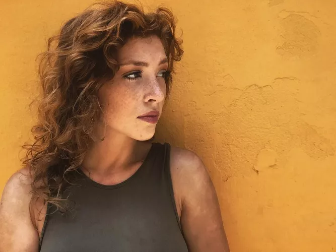 Freckled and fabulous