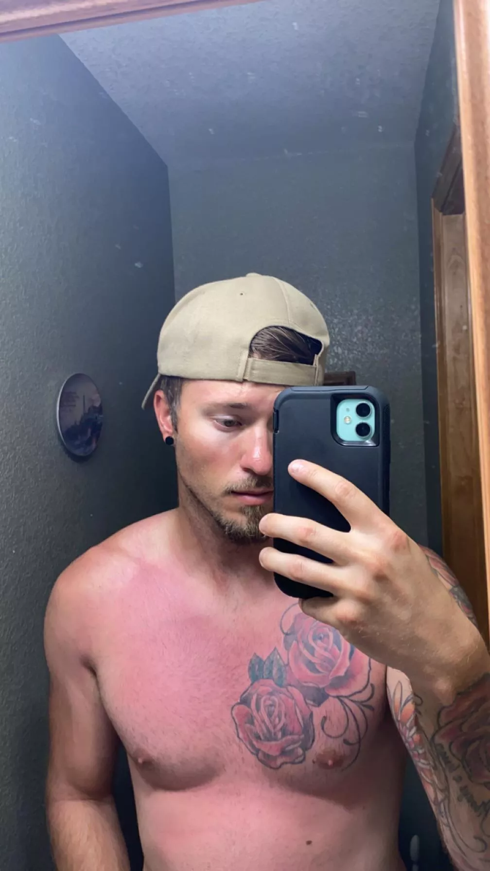 I got a little sunburned this week