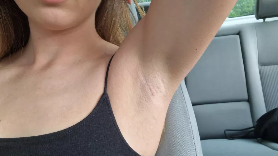 I was so insecure about my armpits