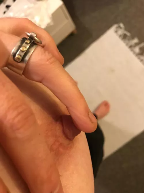 Showing me where she requires my teeth.