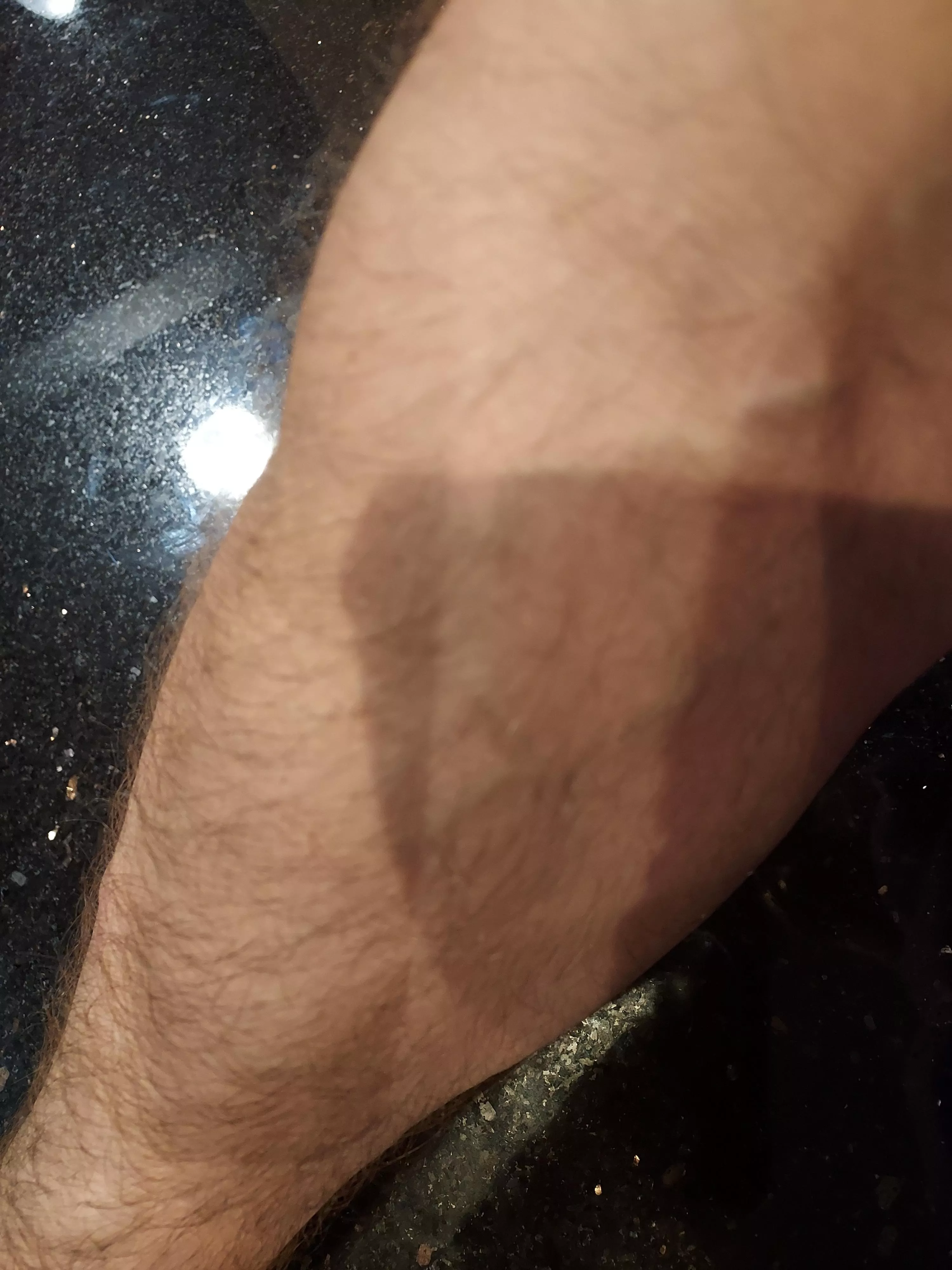 What appendage is that??