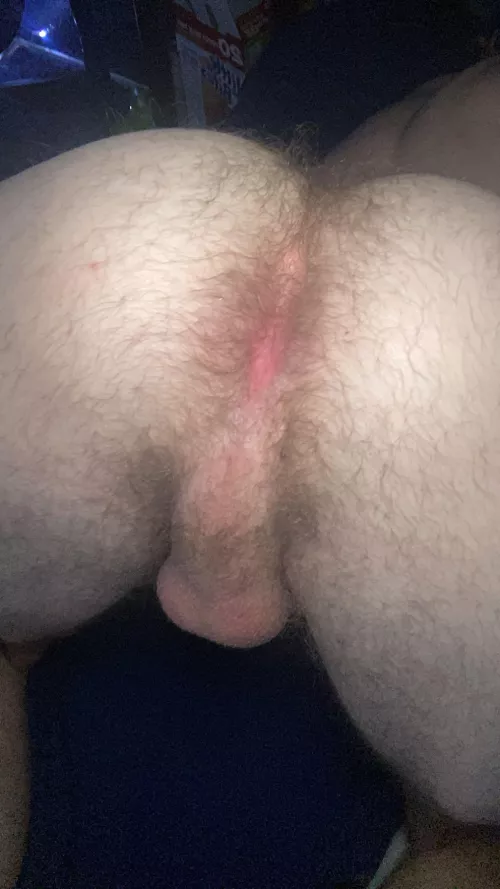 18, In desperate need of a hairy daddy that'll appreciate my hair. Dm me please, sir