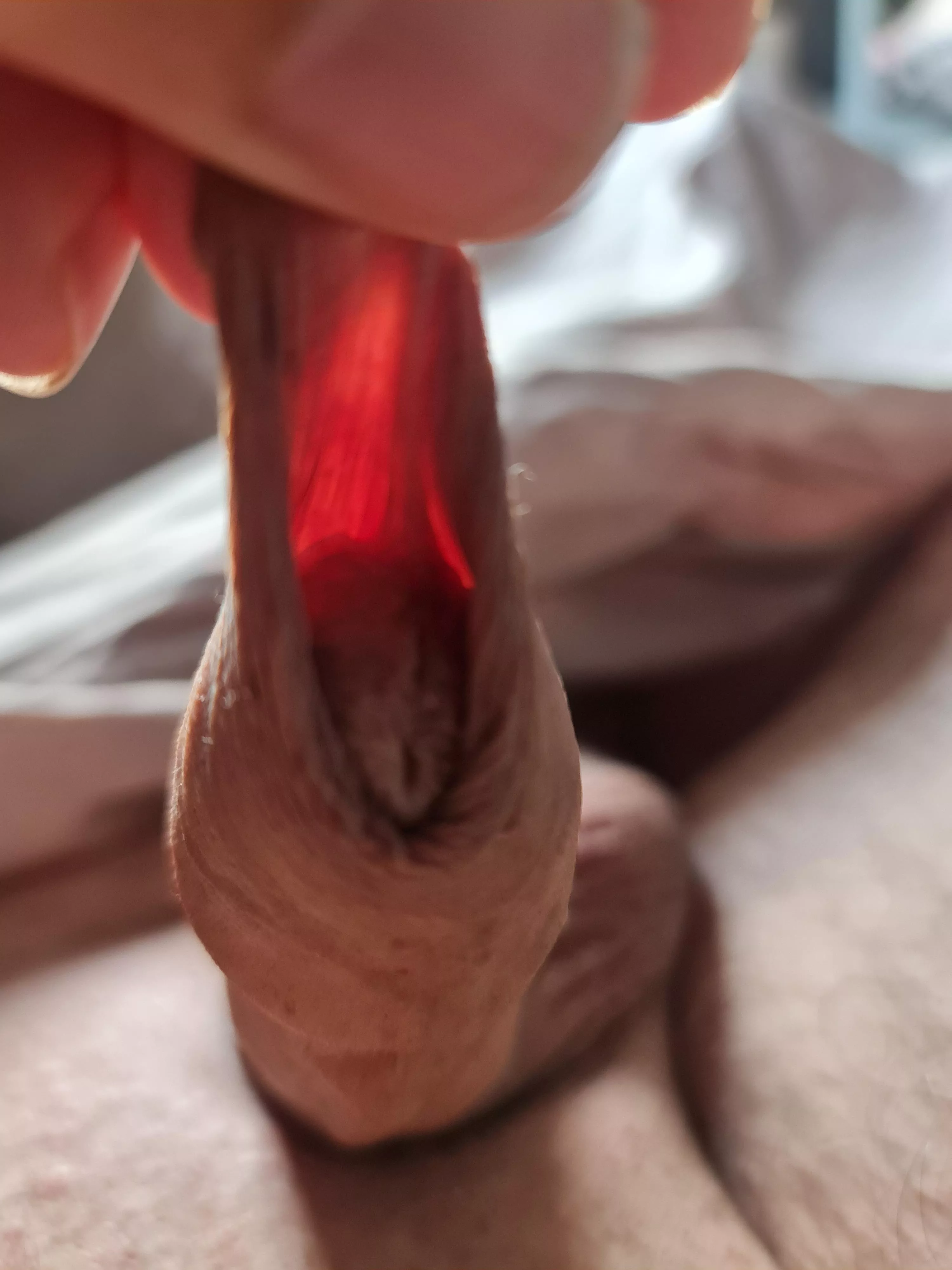 Foreskin under the sun ....(62)