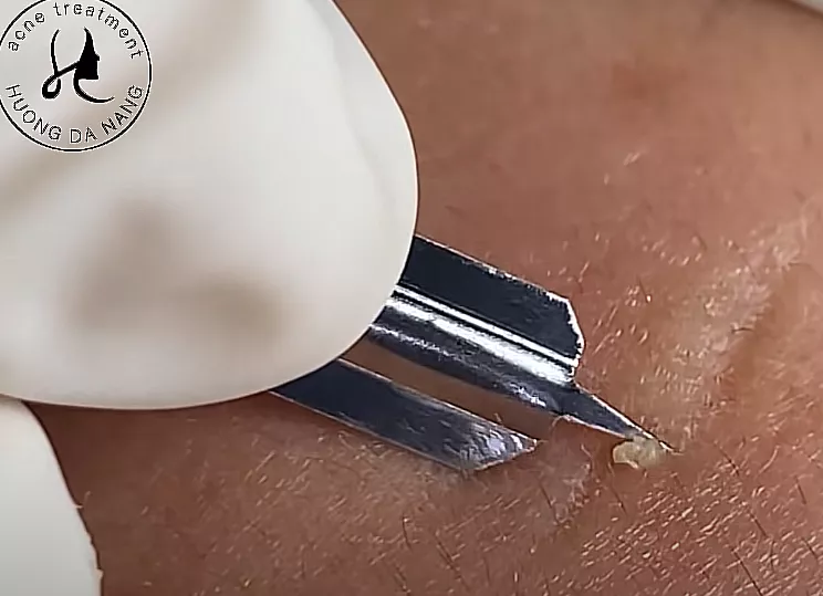 Does anyone know the name of this tool?