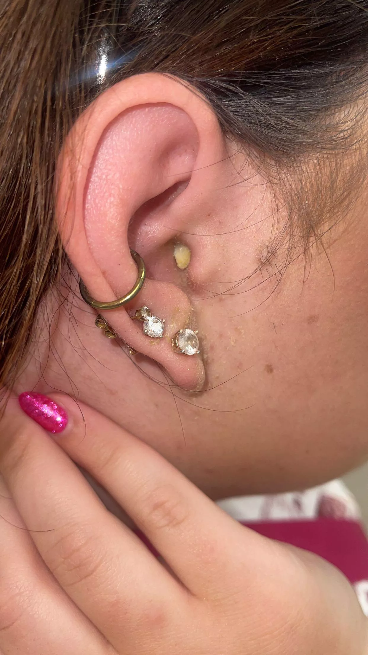 Ear infection! So painful