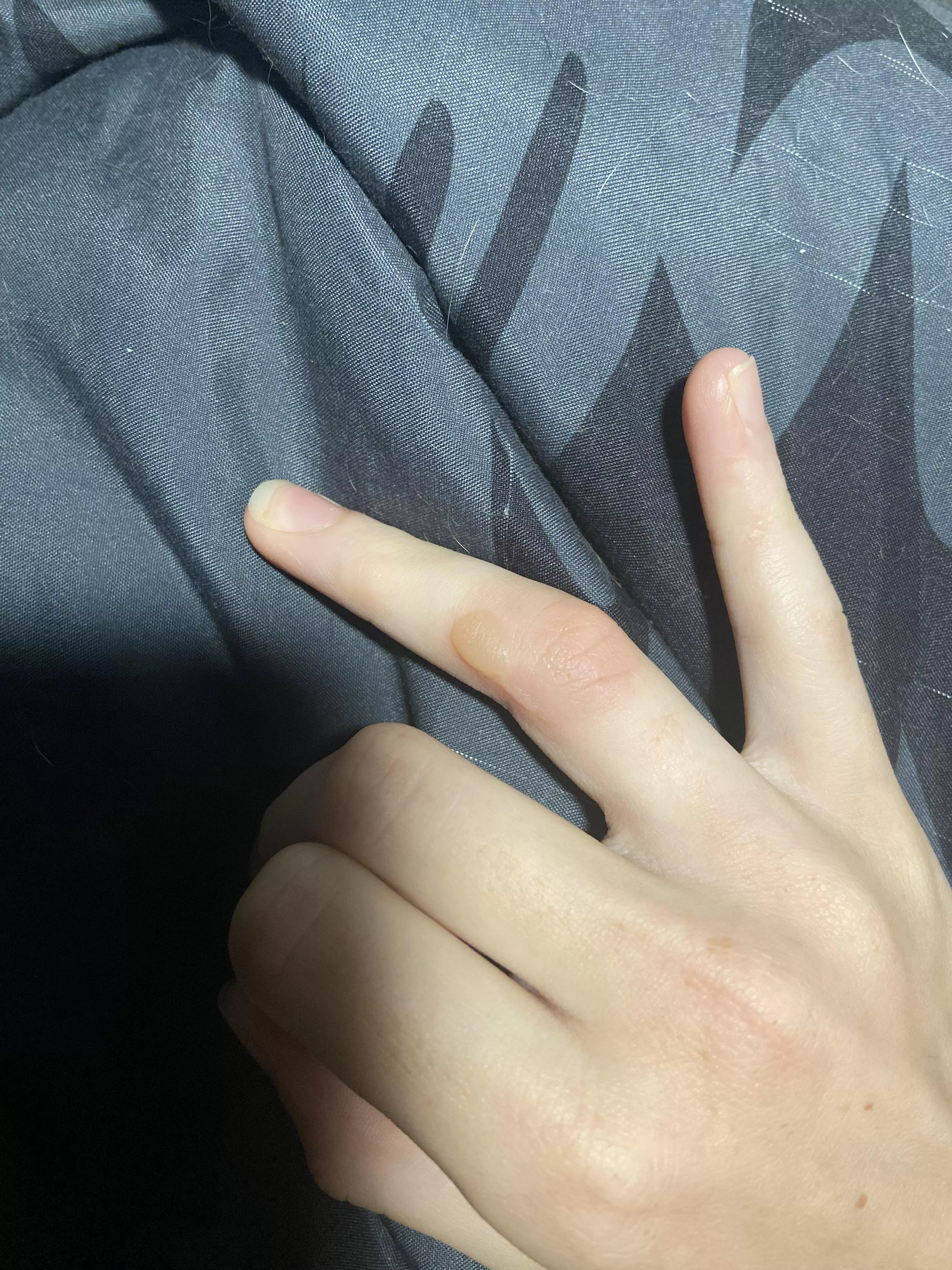 Forbidden pop on finger