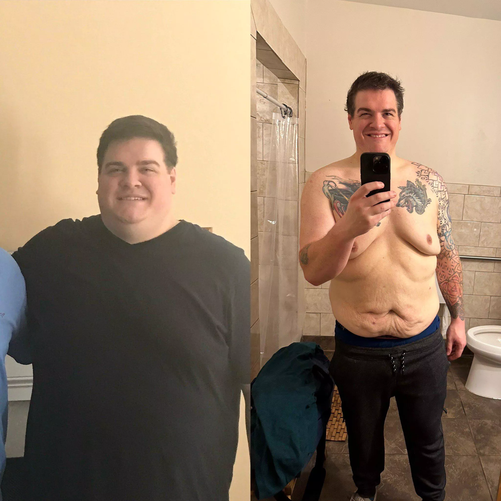 Finally crossed the 150lbs lost milestone and actually starting to have some body positive days Finally crossed the 150lbs lost milestone and actually starting to have some body positive days