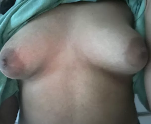 They’re weird when they’re hard. I lost weight and they’re ruined :(