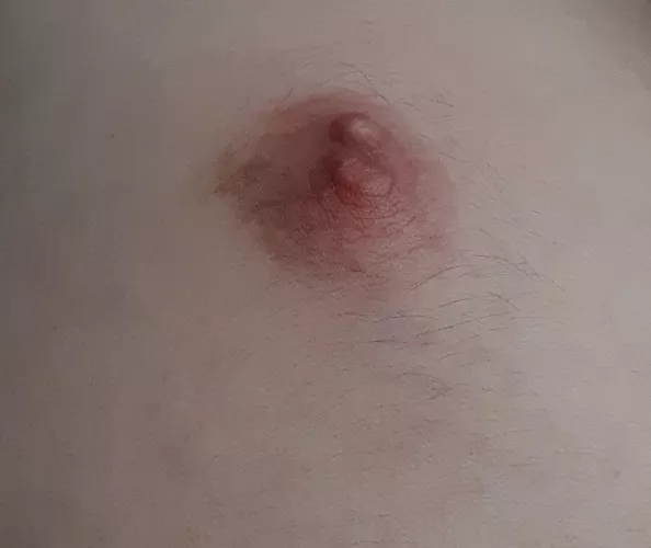 Can anybody tell me what that lump is above my nipple?
