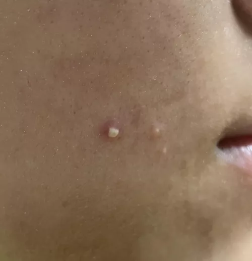 To pop or not to pop…