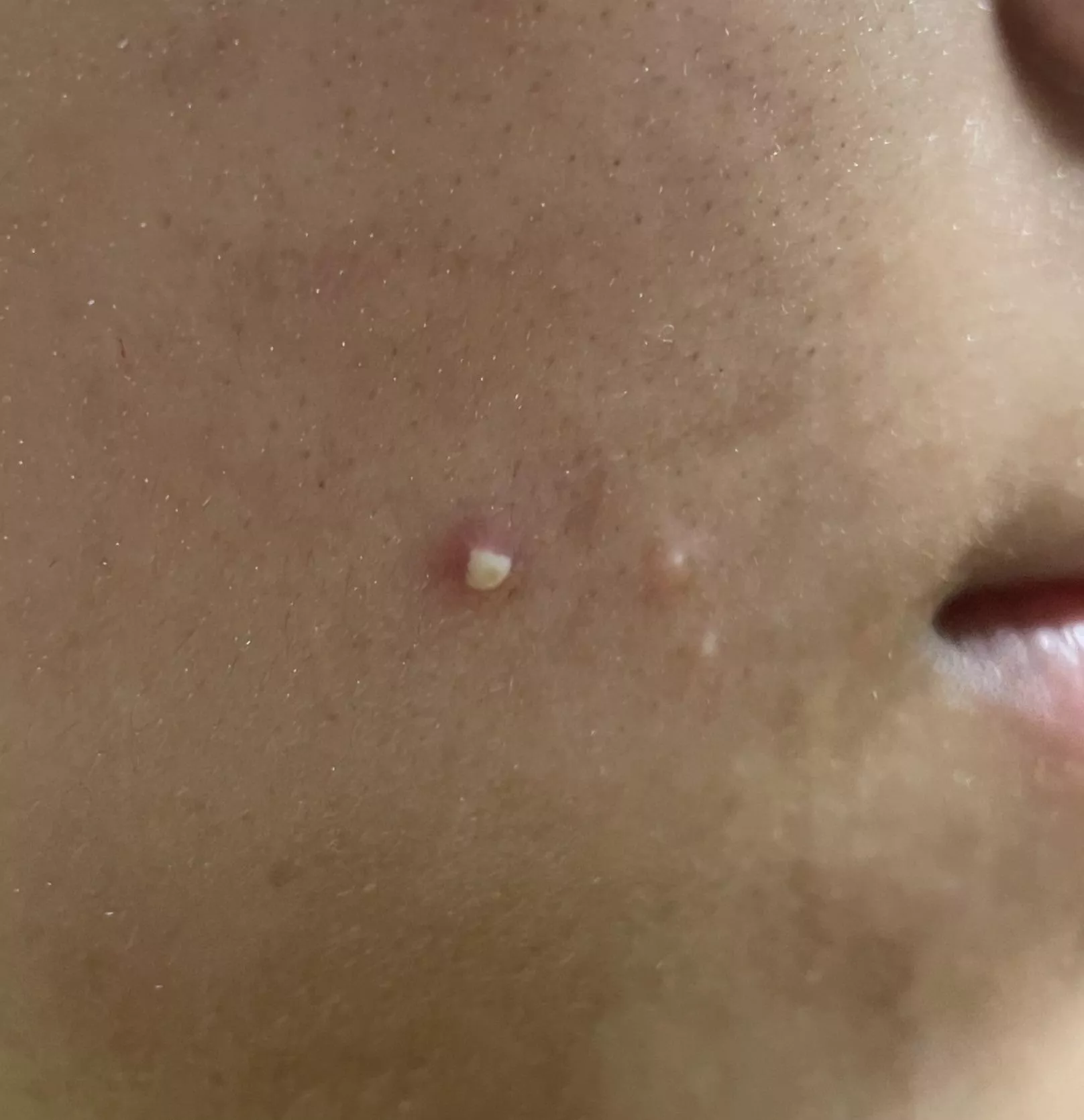 To pop or not to pop…