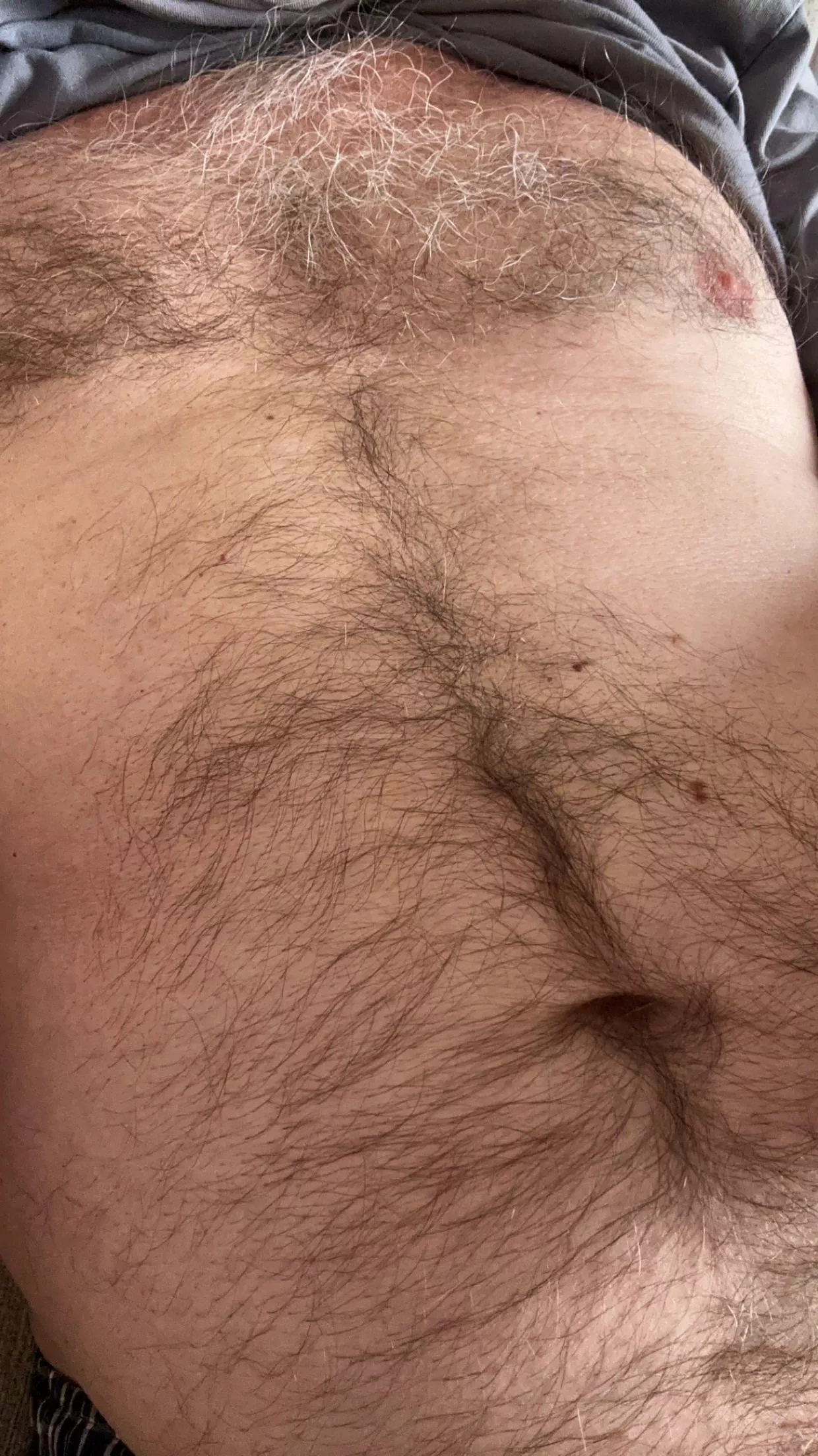 Hairy older