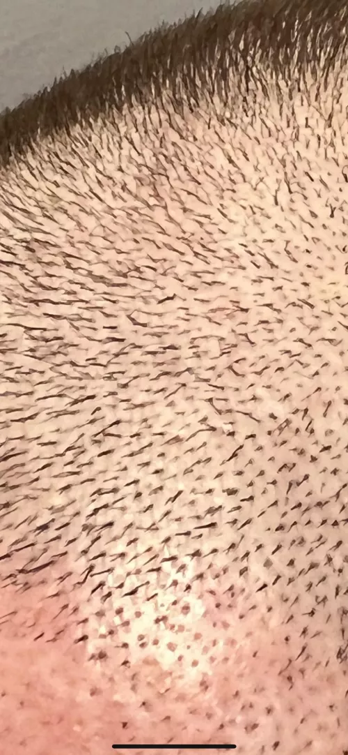 My hair is a subterranean briar patch.