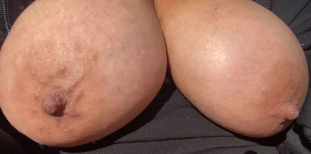 My saggy udder out in Sun - would you please Them?