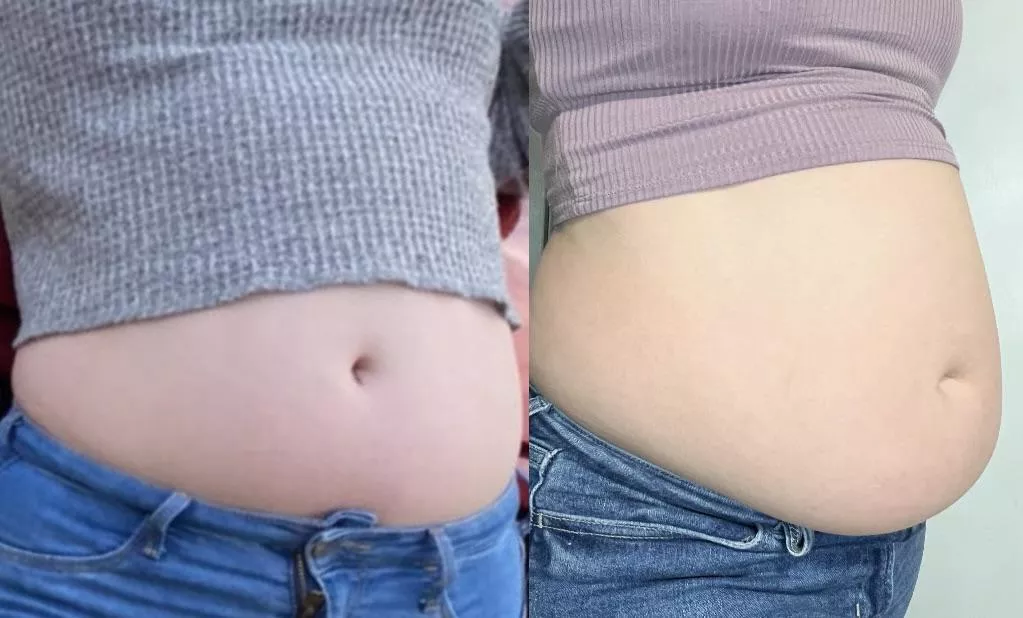 How my “skinny girl” crop tops used to fit vs. how they fit now 😜😅