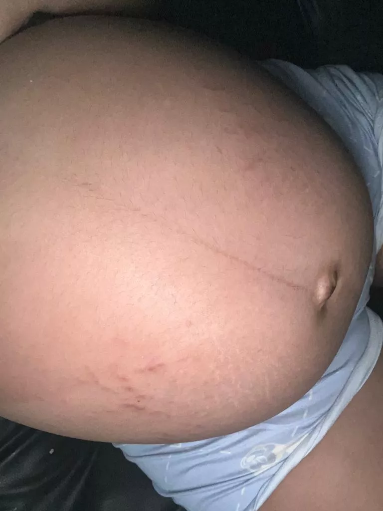 36 weeks pregnant, it's something surprising, it kicks a lot, they want it to be a boy or a girl 😍