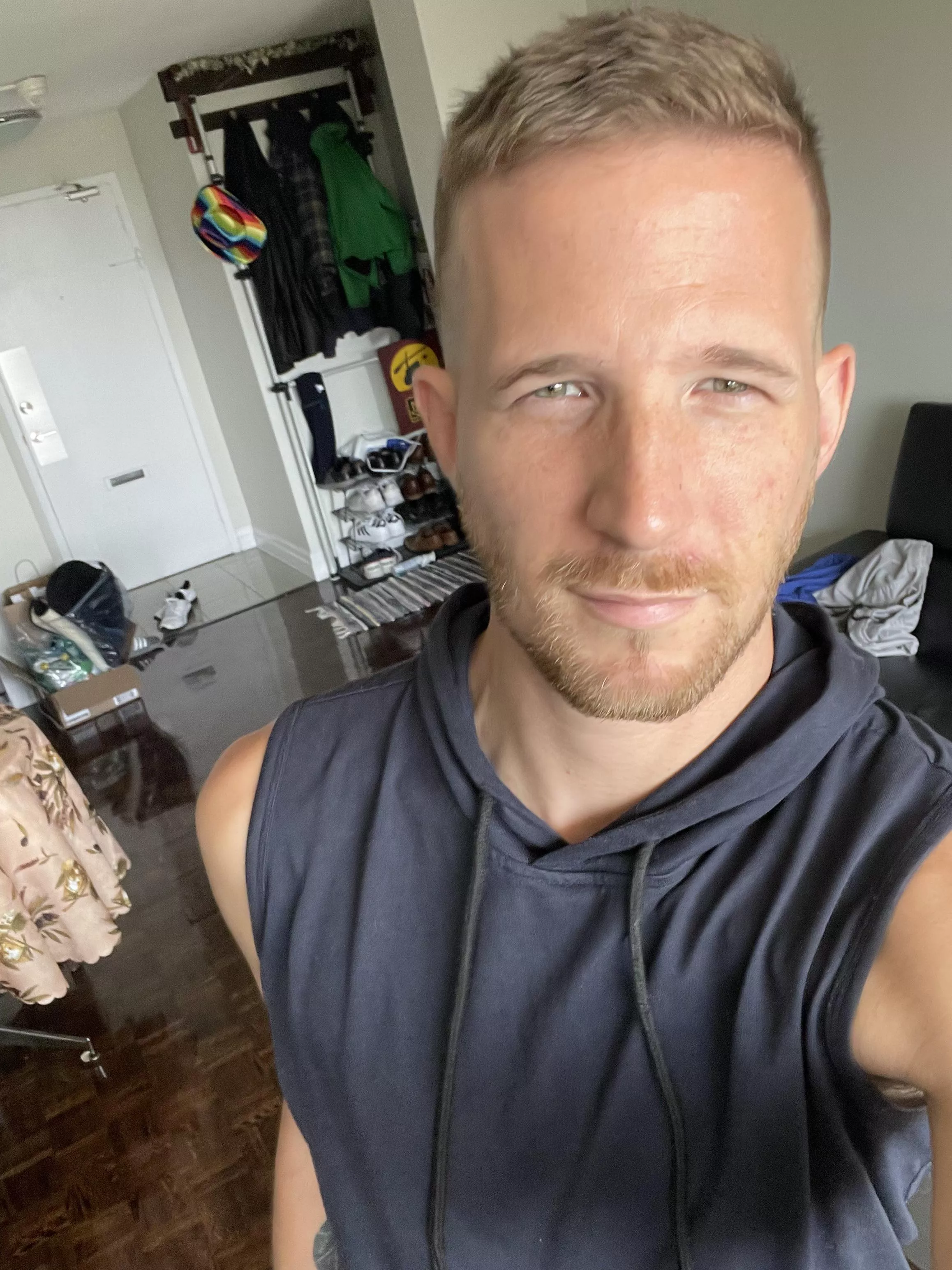 Almost recovered from surgery! Can’t wait to put myself back out thurrrr! Hey guys!