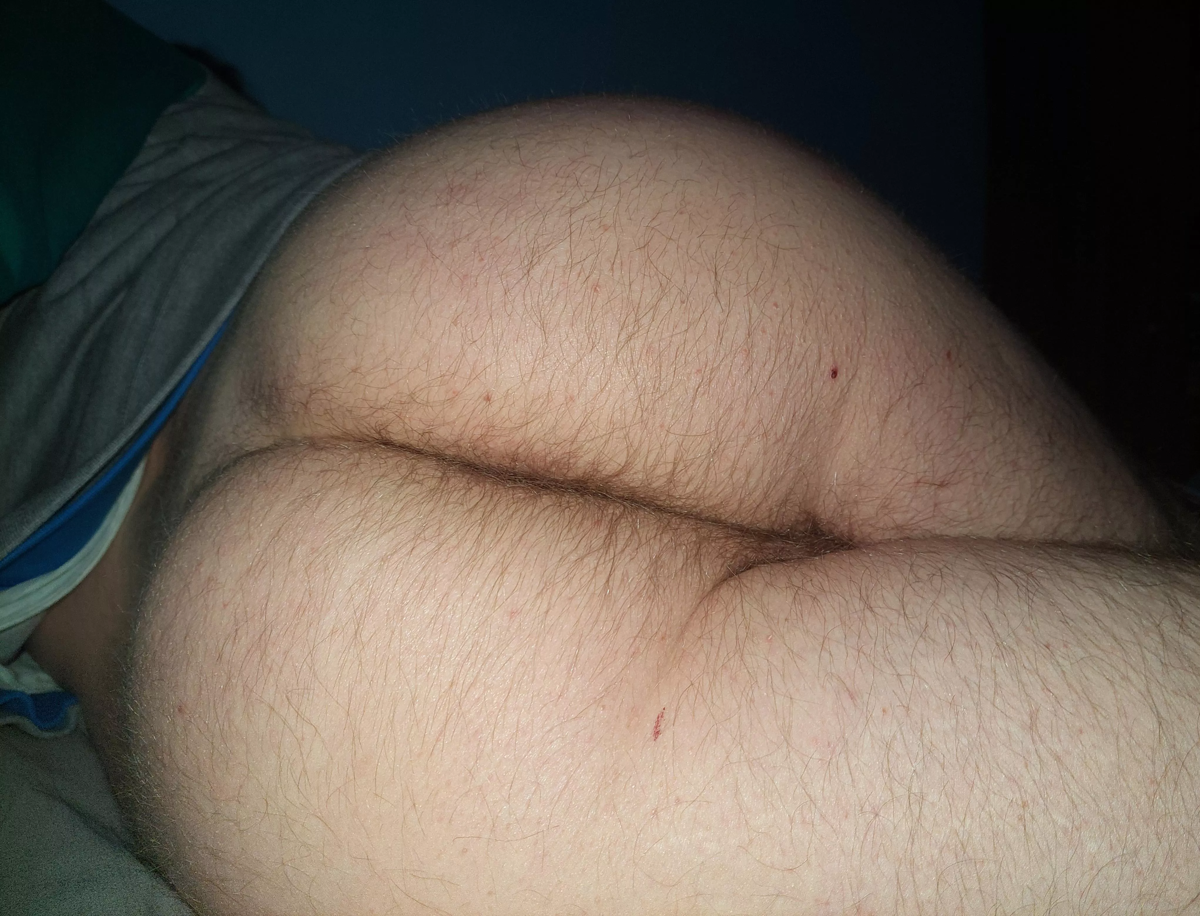 never shaving my ass again