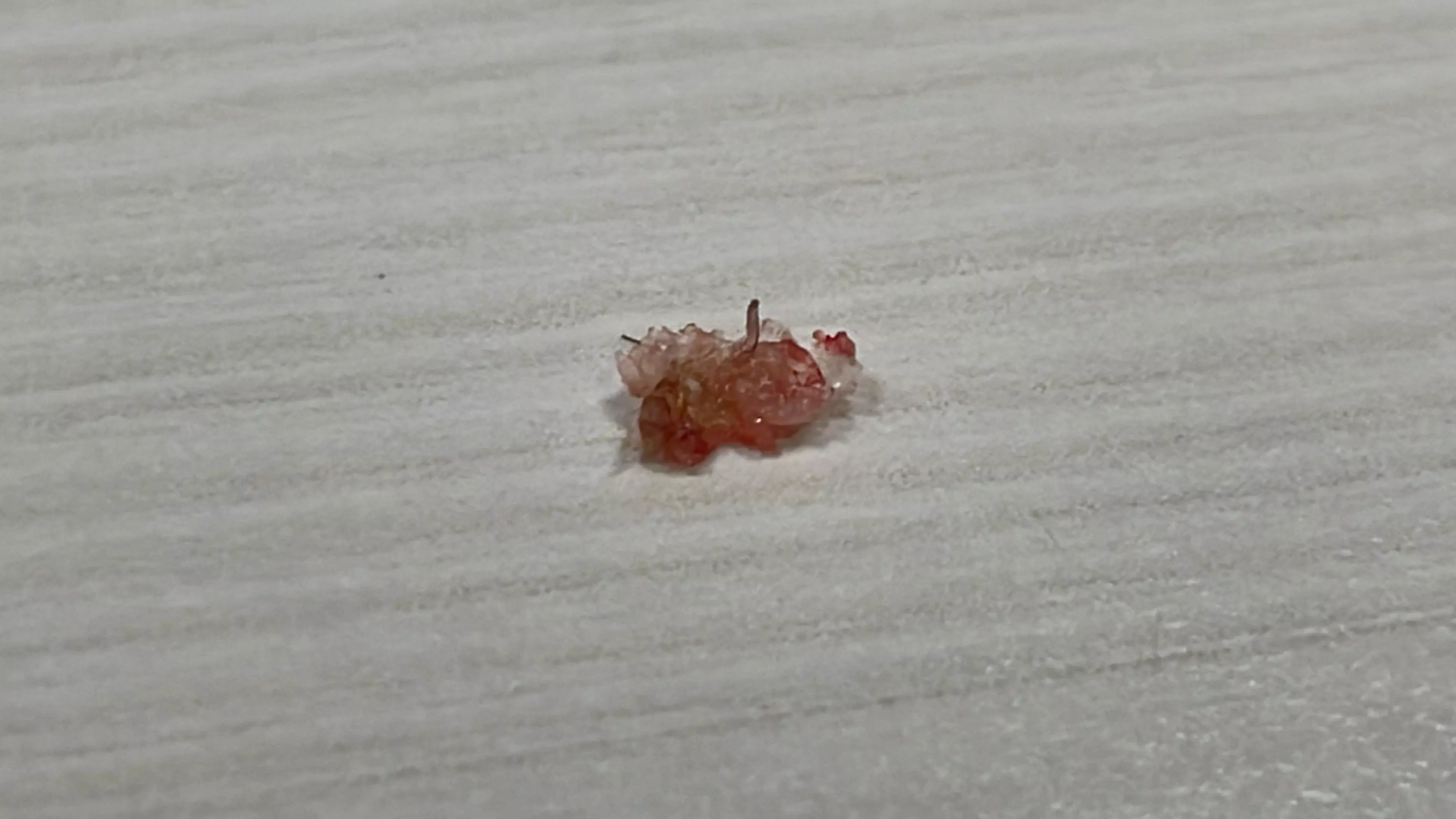 Popped the scab at the back of my head