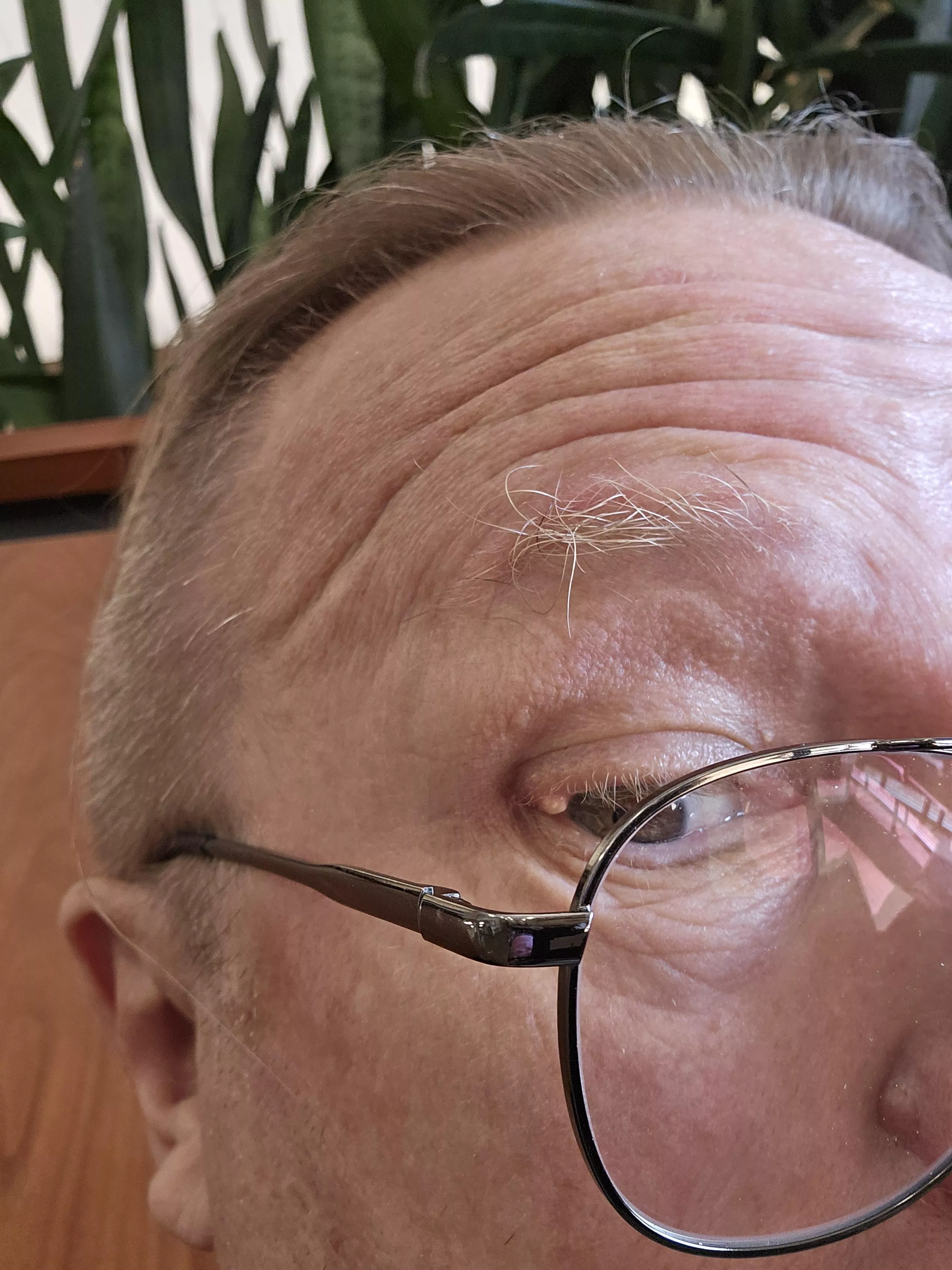 Stye Update, do sending me to specialist Monday. Plugged eyelash folicle.