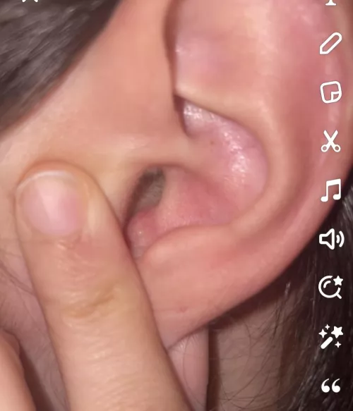 What is this In my ear?
