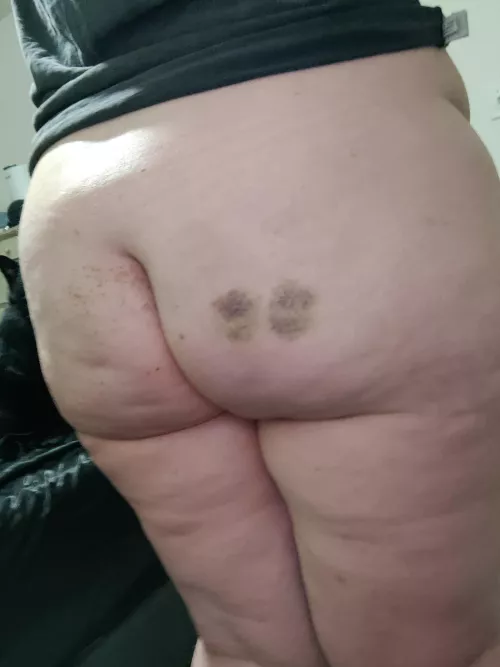 Cum add some more bruises?