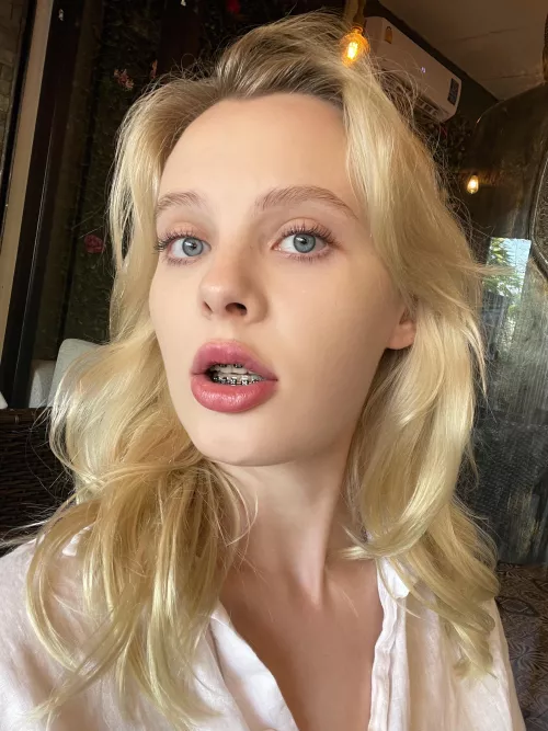 ok then here's my braces!