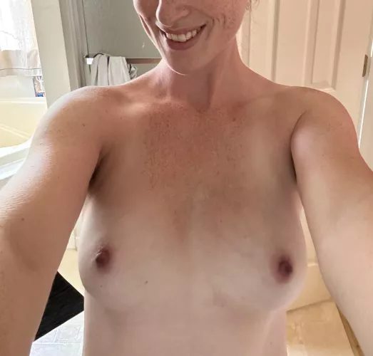 Freckles and smile. Check