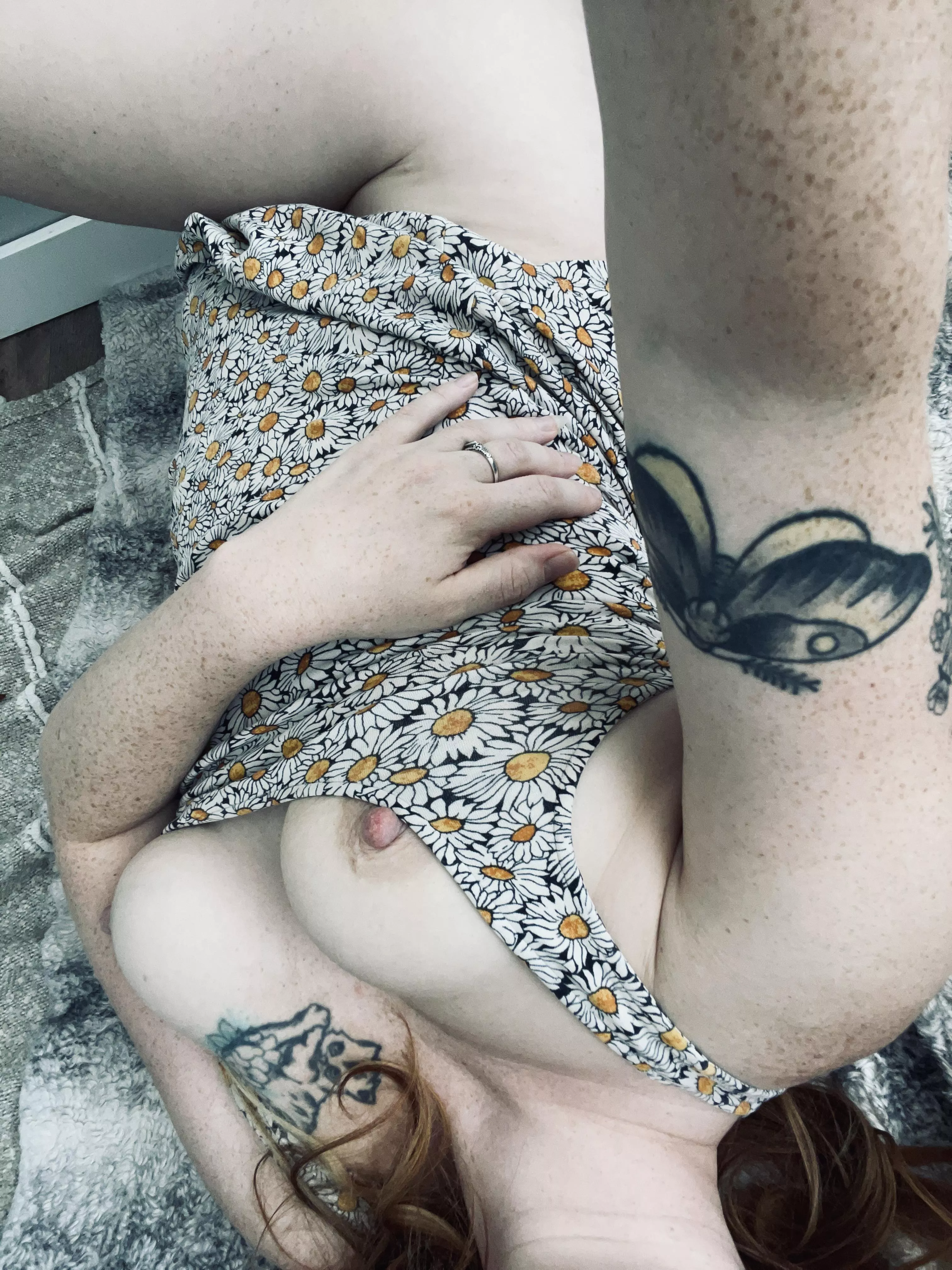 Do you like freckles?