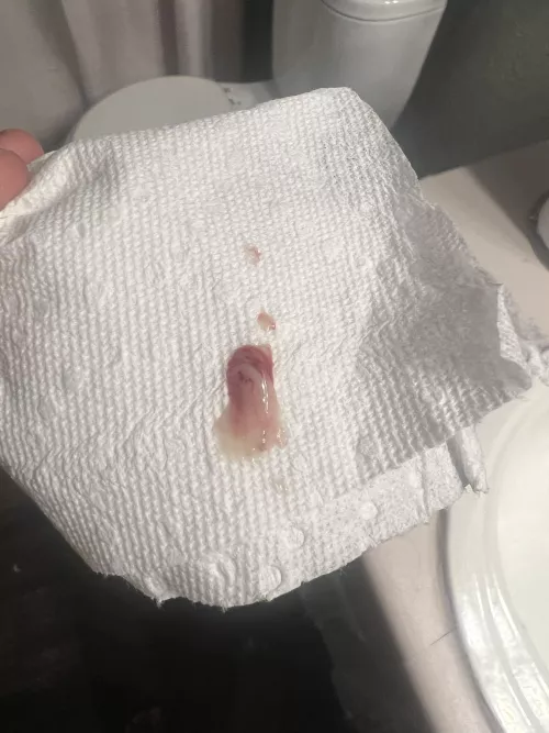 Pop from boyfriends thigh