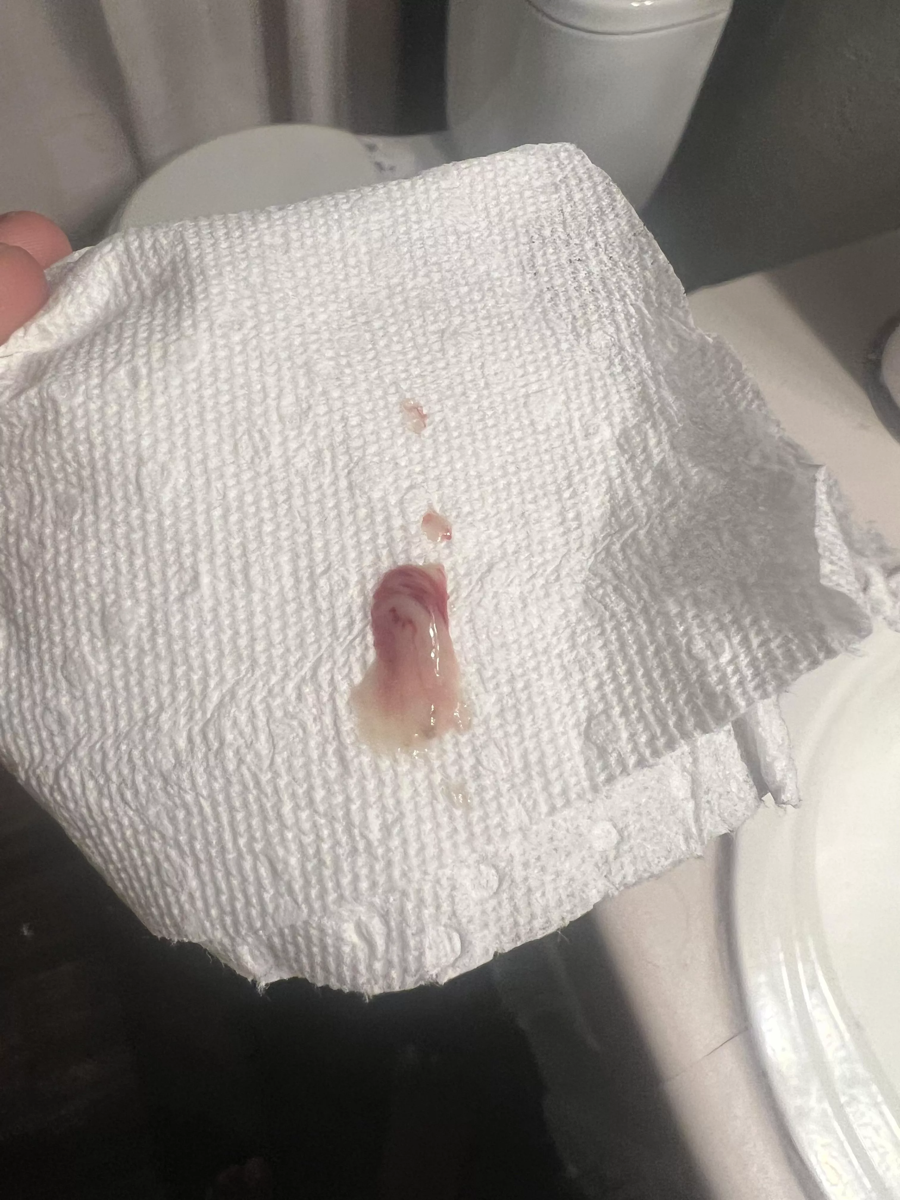 Pop from boyfriends thigh