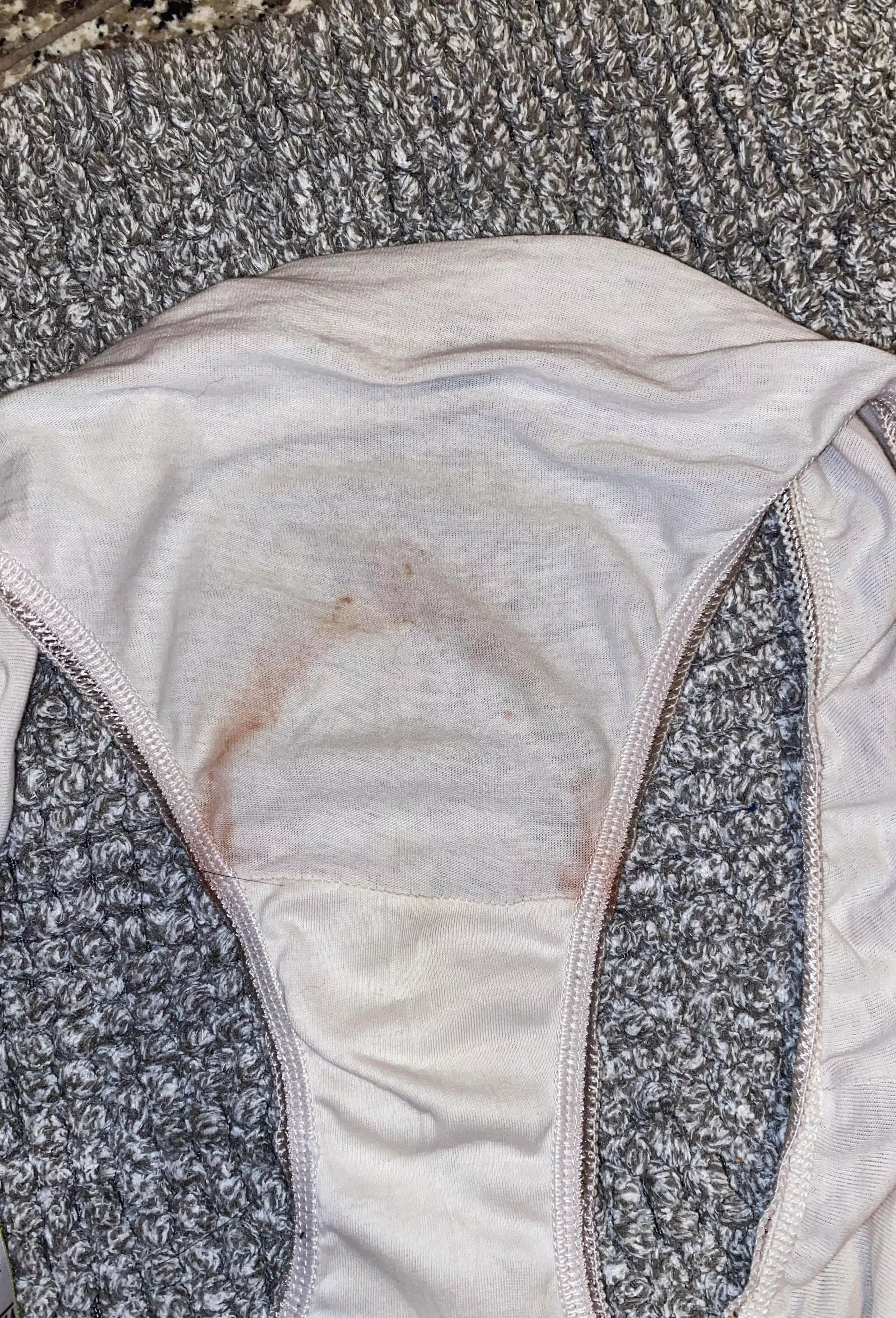 Bled around my pad 🙃