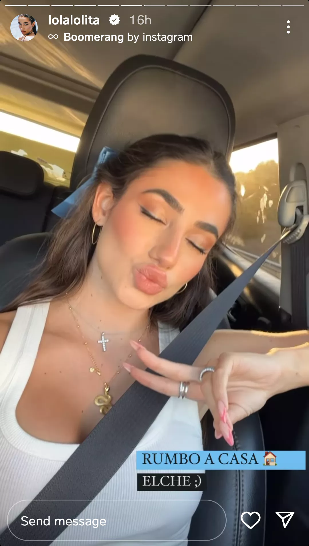 Lola's immaculate pouty face