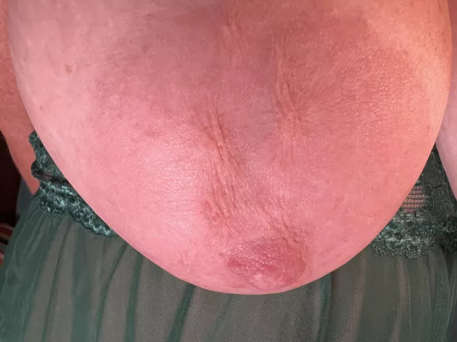 Close up of my big bumpy areola.