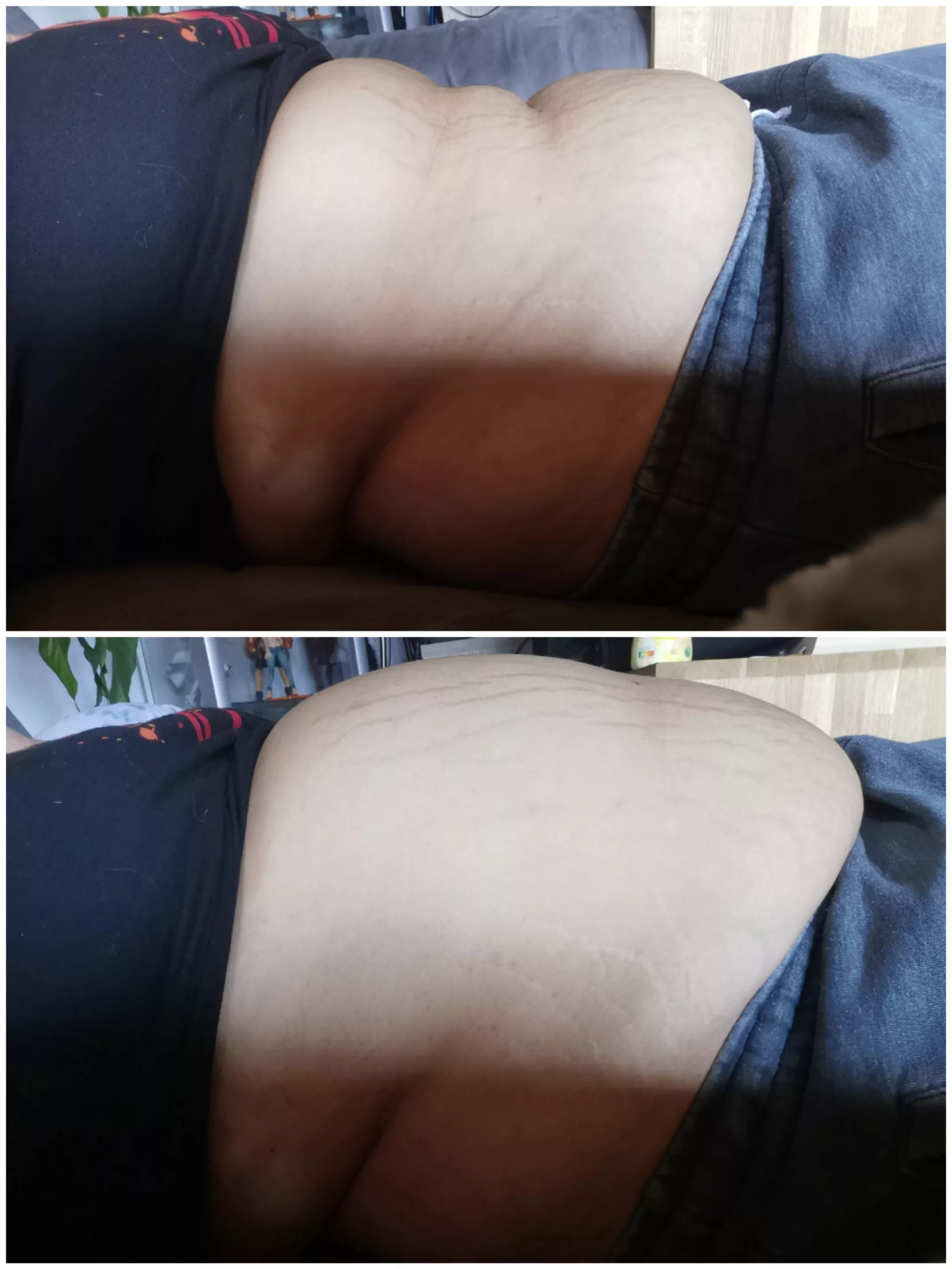 Not very active because of an episode of depression