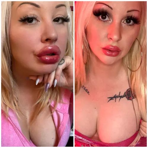 Do my bolted on lips look better on the left or right? More details in full post