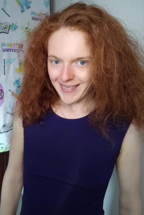 What do you think of my smile today?