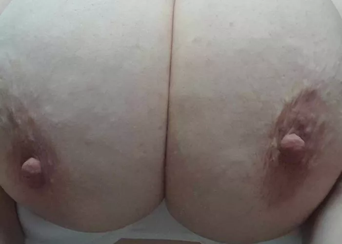 [F] Giving The girls some SUN on this Amazing Melbourne day 😜